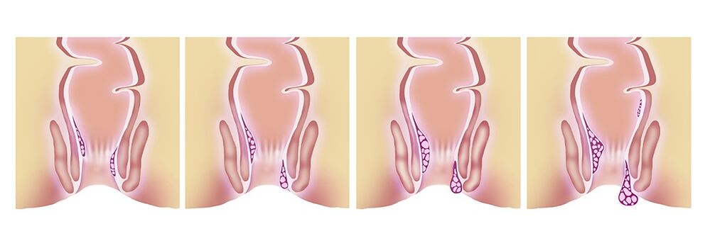 Gelarex is effective at all stages